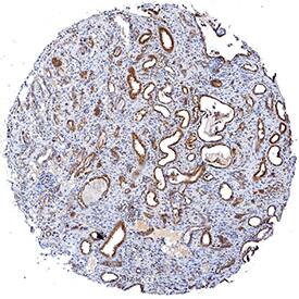 HSPA8/HSC71 was detected in immersion fixed paraffin-embedded sections of human kidney using Goat Anti-Human/Mouse/Rat HSPA8/HSC71 Antigen Affinity-purified Polyclonal Antibody (Catalog # AF4148) at 3 µg/mL for 1 hour at room temperature followed by incubation with the Anti-Goat IgG VisUCyte™ HRP Polymer Antibody (Catalog # VC004). Tissue was stained using DAB (brown) and counterstained with hematoxylin (blue). Specific staining was localized to epithelial cells in convoluted tubules. View our protocol for IHC Staining with VisUCyte HRP Polymer Detection Reagents.