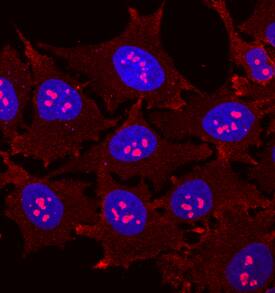 Immunocytochemistry HSPA8/HSC71/Hsc70 Antibody (521503) [Unconjugated]