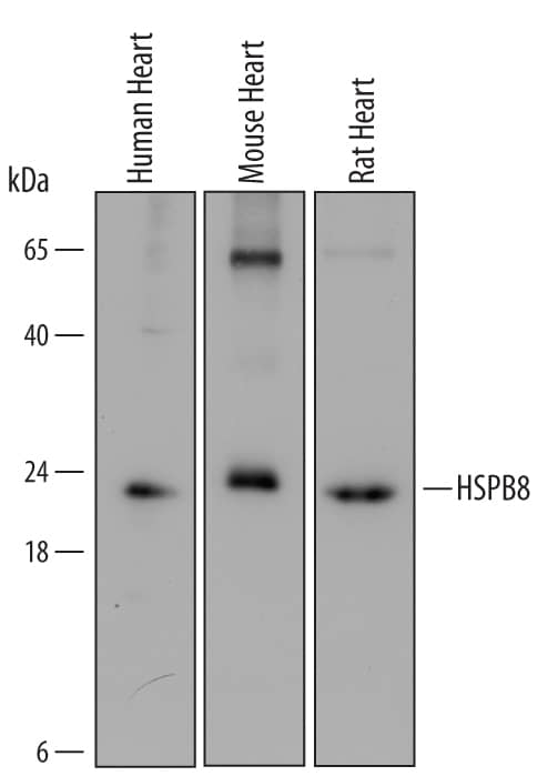Western Blot HSPB8/HSP22 Antibody (520817) [Unconjugated]