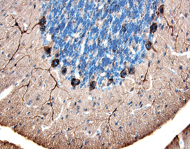 Immunohistochemistry HSPH1/HSP105 Antibody