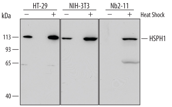 Western blot shows lysates of HT-29 human colon adeno­carcinoma cell line, NIH-3T3 mouse embryonic fibroblast cell line, and Nb2-11 rat lymphoma cell line untreated (-) or treated (+) with heat shock at 42 °C for 30 minutes and allowed to recover at 37 °C for 3 hours. PVDF Membrane was probed with 0.5 µg/mL of Mouse Anti-Human/Mouse/Rat HSPH1 Monoclonal Antibody (Catalog # MAB4029) followed by HRP-conjugated Anti-Mouse IgG Secondary Antibody (Catalog # HAF007). A specific band was detected for HSPH1 at approximately 110 kDa (as indicated). This experiment was conducted under reducing conditions and using Immunoblot Buffer Group 2.
