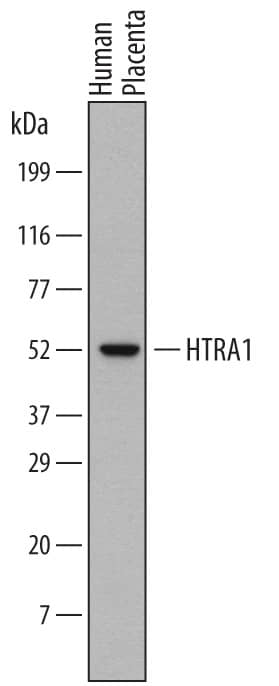 Western Blot HTRA1/PRSS11 Antibody (275615) [Unconjugated]