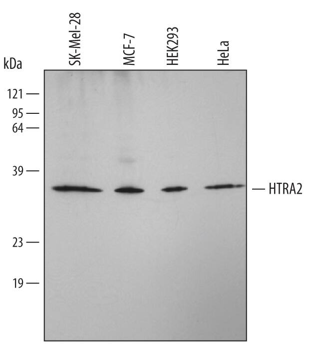 Western Blot HTRA2/Omi Antibody (229926) [Unconjugated]