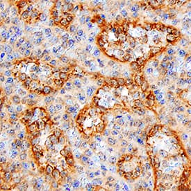 HVEM/TNFRSF14 was detected in immersion fixed paraffin-embedded sections of human spleen using Goat Anti-Human HVEM/TNFRSF14 Antigen Affinity-purified Polyclonal Antibody (Catalog # AF356) at 10 µg/mL for 1 hour at room temperature followed by incubation with the Anti-Goat IgG VisUCyte™ HRP Polymer Antibody (VC004). Tissue was stained using DAB (brown) and counterstained with hematoxylin (blue). Specific staining was localized to cell surfaces. View our protocol for IHC Staining with VisUCyte HRP Polymer Detection Reagents.