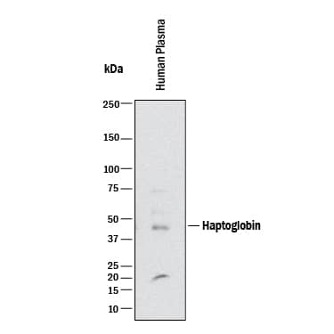 Western blot shows human plasma. PVDF membrane was probed with 0.1 µg/mL of Goat Anti-Human/Mouse Haptoglobin Antigen Affinity-purified Polyclonal Antibody (Catalog # AF8465) followed by HRP-conjugated Anti-Goat IgG Secondary Antibody (Catalog # HAF017). A specific band was detected for Haptoglobin at approximately 45 kDa (as indicated). This experiment was conducted under reducing conditions and using Immunoblot Buffer Group 1.
