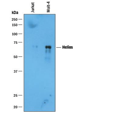 Helios was immunoprecipitated from 400 µg of Jurkat human acute T cell leukemia cell line and MOLT-4 human acute lymphoblastic leukemia cell line lysates using 4 µg of Sheep Anti-Human Helios Antigen Affinity-purified Polyclonal Antibody (Catalog # AF73091) coated on 4 wells of a 96 well plate (Corning Costar EIA/RIA). Jurkat or MOLT-4 lysates were added to the wells and incubated for 2 hours at room temperature. Immunoprecipitated Helios was detected by Western blot under reducing conditions using 0.1 µg/mL Mouse Anti-Human Helios Monoclonal Antibody (Catalog # MAB73091) and Immunoblot Buffer Group 1. View our recommended buffer recipes for Immunoprecipitation.