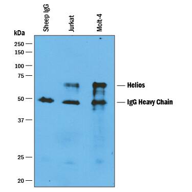 Helios was immunoprecipitated from 400 µg of Jurkat human acute T cell leukemia cell line and MOLT‑4 human acute lymphoblastic leukemia cell line lysates using 4 µg of Sheep Anti-Human Helios Antigen Affinity-purified Polyclonal Antibody (Catalog # AF73091) coated on 4 wells of a 96 well plate (Corning Costar EIA/RIA). Jurkat lysates, MOLT‑4 lysates, or control buffer were added to the wells and incubated for 2 hours at room temperature. Immunoprecipitated Helios was detected by Western blot under reducing conditions using 0.1 µg/mL Sheep Anti-Human Helios Antigen Affinity-purified Polyclonal Antibody (Catalog # AF73091) and Immunoblot Buffer Group 1. View our recommended buffer recipes for Immunoprecipitation.