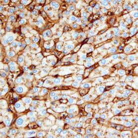 Hemopexin was detected in immersion fixed paraffin-embedded sections of human liver using Sheep Anti-Human Hemopexin Antigen Affinity-purified Polyclonal Antibody (Catalog # AF4490) at 3 µg/mL overnight at 4 °C. Before incubation with the primary antibody, tissue was subjected to heat-induced epitope retrieval using Antigen Retrieval Reagent-Basic (Catalog # CTS013). Tissue was stained using the Anti-Sheep HRP-DAB Cell & Tissue Staining Kit (brown; Catalog # CTS019) and counter-stained with hematoxylin (blue). Specific staining was localized to bile canaliculi. View our protocol for Chromogenic IHC Staining of Paraffin-embedded Tissue Sections.