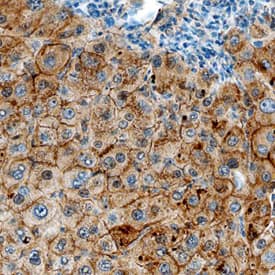 Immunohistochemistry Hemopexin Antibody (698813)