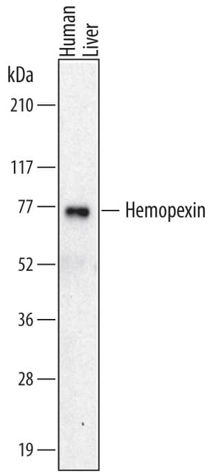 Western Blot Hemopexin Antibody (698813)