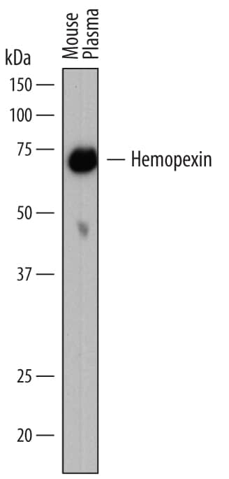 Western Blot Hemopexin Antibody (781941)