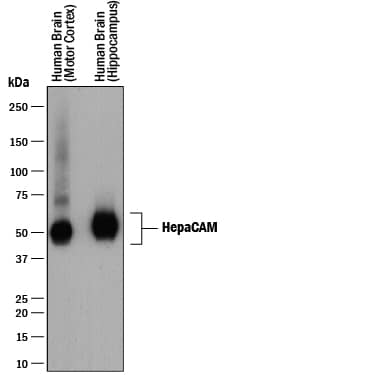 Western Blot HepaCAM Antibody (419305) [Unconjugated]