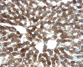 Hepassocin/FGL1 was detected in perfusion fixed frozen sections of rat liver using 15 µg/mL Goat Anti-Rat Hepassocin/FGL1 Antigen Affinity-purified Polyclonal Antibody (Catalog # AF1105) overnight at 4 °C. Tissue was stained with the Anti-Goat HRP-DAB Cell & Tissue Staining Kit (brown; Catalog # CTS008) and counterstained with hematoxylin (blue). View our protocol for Chromogenic IHC Staining of Frozen Tissue Sections.