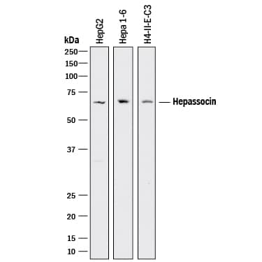 Western blot shows lysates of HepG2 human hepatocellular carcinoma cell line, Hepa 1-6 mouse hepatoma cell line, and H4-II-E-C3 rat hepatoma cell line. PVDF membrane was probed with 1 µg/mL of Goat Anti-Human/ Mouse/Rat Hepassocin/FGL1 Antigen Affinity-purified Polyclonal Antibody (Catalog # AF1614) followed by HRP-conjugated Anti-Goat IgG Secondary Antibody (Catalog # HAF017). A specific band was detected for Hepassocin/FGL1 homodimer at approximately 65 kDa (as indicated). Hepassocin/FGL1 is resistant to reducing conditions (1). This experiment was conducted under reducing conditions and using Immunoblot Buffer Group 1.