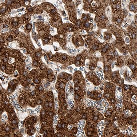 Immunohistochemistry Hepassocin/FGL1 Antibody (1016010) [Unconjugated]