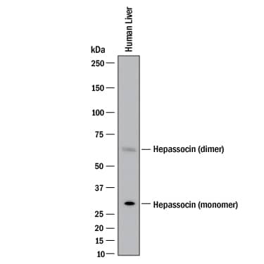 Western Blot Hepassocin/FGL1 Antibody (1016010) [Unconjugated]