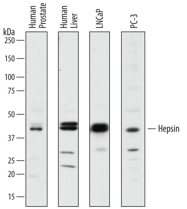 Western blot shows lysates of human prostate tissue, human liver tissue, LNCaP human prostate cancer cell line, and PC-3 human prostate cancer cell line. PVDF membrane was probed with 2 µg/mL of Sheep Anti-Human Hepsin Antigen Affinity-purified Polyclonal Antibody (Catalog # AF4776) followed by HRP-conjugated Anti-Sheep IgG Secondary Antibody (Catalog # HAF016). A specific band was detected for Hepsin at approximately 45 kDa (as indicated). This experiment was conducted under reducing conditions and using Immunoblot Buffer Group 7.