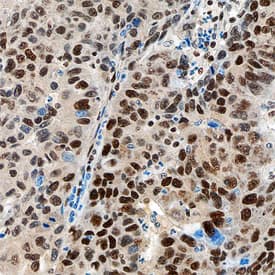 Immunohistochemistry Hexim 1 Antibody