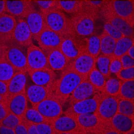 Histone Deacetylase 4/HDAC4 was detected in immersion fixed MCF-7 human breast cancer cell line using Sheep Anti-Human/Mouse/Rat Histone Deacetylase 4/ HDAC4 Antigen Affinity-purified Polyclonal Antibody (Catalog # AF6205) at 10 µg/mL for 3 hours at room temperature. Cells were stained using the NorthernLights™ 557-conjugated Anti-Sheep IgG Secondary Antibody (red; Catalog # NL010) and counterstained with DAPI (blue). Specific staining was localized to cytoplasm. View our protocol for Fluorescent ICC Staining of Cells on Coverslips.