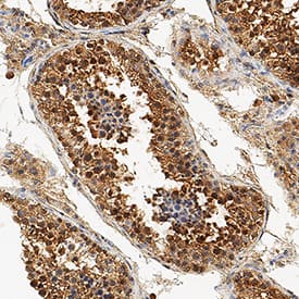 Histone Deacetylase 4/HDAC4 was detected in immersion fixed paraffin-embedded sections of human testis using Mouse Anti-Human Histone Deacetylase 4/HDAC4 Monoclonal Antibody (Catalog # MAB6205) at 5 µg/mL for 1 hour at room temperature followed by incubation with the Anti-Mouse IgG VisUCyte™ HRP Polymer Antibody (Catalog # VC001). Tissue was stained using DAB (brown) and counterstained with hematoxylin (blue). Specific staining was localized to cytoplasm and nuclei of sperm cells. View our protocol for IHC Staining with VisUCyte HRP Polymer Detection Reagents.