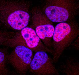 <b>Biological Strategies Validation. </b>Histone H2AX phosphorylated at S139 was detected in immersion fixed HeLa human cervical epithelial carcinoma cell line treated with ultraviolet radiation using Rabbit Anti-Human Phospho-Histone H2AX (S139) Antigen Affinity-purified Polyclonal Antibody (Catalog # AF2288) at 10 µg/mL for 3 hours at room temperature. Cells were stained using the NorthernLights™ 557-conjugated Anti-Rabbit IgG Secondary Antibody (red; Catalog # NL004) and counterstained with DAPI (blue). Specific staining was localized to nuclei. View our protocol for Fluorescent ICC Staining of Cells on Coverslips.