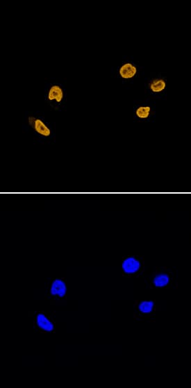 Histone H2AY was detected in immersion fixed HeLa human cervical epithelial carcinoma cell line using Mouse Anti-Human/Mouse/Rat Histone H2AY Monoclonal Antibody (Catalog # MAB8318) at 25 µg/mL for 3 hours at room temperature. Cells were stained using the NorthernLights™ 557-conjugated Anti-Mouse IgG Secondary Antibody (yellow, upper panel; Catalog # NL007) and counterstained with DAPI (blue, lower panel). Specific staining was localized to nuclei. View our protocol for Fluorescent ICC Staining of Cells on Coverslips.