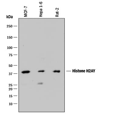 Western blot shows lysates of MCF-7 human breast cancer cell line, Hepa 1-6 mouse hepatoma cell line, and Rat-2 rat embryonic fibroblast cell line. PVDF membrane was probed with 2 µg/mL of Mouse Anti-Human/Mouse/Rat Histone H2AY Monoclonal Antibody (Catalog # MAB8318) followed by HRP-conjugated Anti-Mouse IgG Secondary Antibody (Catalog # HAF018). A specific band was detected for Histone H2AY at approximately 40 kDa (as indicated). This experiment was conducted under reducing conditions and using Immunoblot Buffer Group 1.