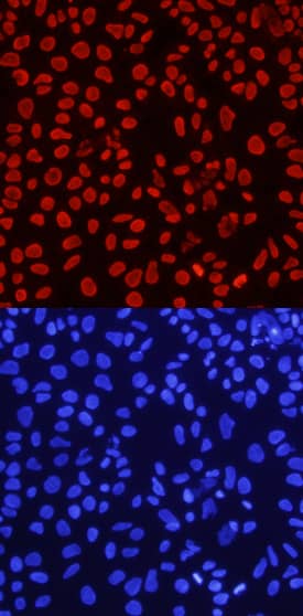 Histone H4 was detected in immersion fixed NTera-2 human testicular embryonic carcinoma cell line using Sheep Anti-Human Acetyl Histone H4 Antigen Affinity-purified Polyclonal Antibody (Catalog # AF5215) at 10 µg/mL for 3 hours at room temperature. Cells were stained using the NorthernLights™ 557-conjugated Anti-Sheep IgG Secondary Antibody (red, upper panel; Catalog # NL010) and counterstained with DAPI (blue, lower panel). Specific staining was localized to nuclei. View our protocol for Fluorescent ICC Staining of Cells on Coverslips.