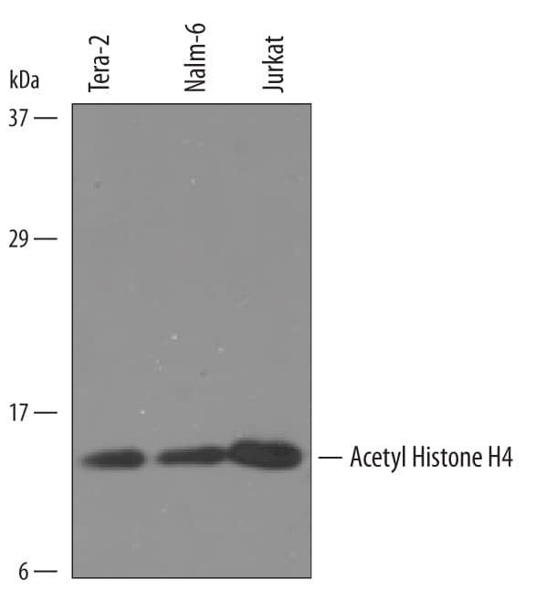 Western blot shows lysates of Tera-2 human embryonic lung carcinoma cell line, Nalm-6 human Pre-B acute lymphocytic leukemia cell line, and Jurkat human acute T cell leukemia cell line. PVDF Membrane was probed with 1 µg/mL of Sheep Anti-Human Acetyl Histone H4 Antigen Affinity-purified Polyclonal Antibody (Catalog # AF5215) followed by HRP-conjugated Anti-Sheep IgG Secondary Antibody (Catalog # HAF016). A specific band was detected for Acetyl Histone H4 at approximately 12 kDa (as indicated). This experiment was conducted under reducing conditions and using Immunoblot Buffer Group 8.