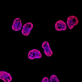 <b>Biological Strategies Validation. </b>Histone H4 was detected in immersion fixed HeLa human cervical epithelial carcinoma cell line using Rabbit Anti-Human Acetyl Histone H4 (Lys5) Monoclonal Antibody (Catalog # MAB9549) at 0.1 µg/mL for 3 hours at room temperature. Cells were stained using the NorthernLights™ 557-conjugated Anti-Rabbit IgG Secondary Antibody (red; Catalog # NL004) and counterstained with DAPI (blue). Specific staining was localized to nuclei. View our protocol for Fluorescent ICC Staining of Cells on Coverslips.