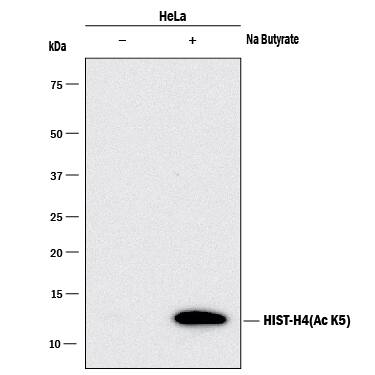 Western blot shows lysates of HeLa human cervical epithelial carcinoma cell line untreated (-) or treated (+) with 10mM Sodium (Na) Butyrate for 24 hours. PVDF membrane was probed with 0.1 µg/mL of Rabbit Anti-Human Acetyl Histone H4 (Lys5) Monoclonal Antibody (Catalog # MAB9549) followed by HRP-conjugated Anti-Rabbit IgG Secondary Antibody (Catalog # HAF008). A specific band was detected for Acetyl Histone H4 (Lys5) at approximately 12 kDa (as indicated). This experiment was conducted under reducing conditions and using Immunoblot Buffer Group 1.