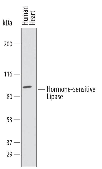 Western blot shows lysates of human heart tissue. PVDF membrane was probed with 1 µg/mL of Sheep Anti-Human Hormone-sensitive Lipase/HSL Antigen Affinity-purified Polyclonal Antibody (Catalog # AF7104) followed by HRP-conjugated Anti-Sheep IgG Secondary Antibody (Catalog # HAF016). A specific band was detected for Hormone-sensitive Lipase/HSL at approximately 90 kDa (as indicated). This experiment was conducted under reducing conditions and using Immunoblot Buffer Group 1.