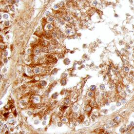Hormone-sensitive Lipase/HSL was detected in immersion fixed paraffin-embedded sections of human testis using Mouse Anti-Human Hormone-sensitive Lipase/HSL Monoclonal Antibody (Catalog # MAB7104) at 8 µg/mL overnight at 4 °C. Tissue was stained using the Anti-Mouse HRP-DAB Cell & Tissue Staining Kit (brown; Catalog # CTS002) and counterstained with hematoxylin (blue). Specific staining was localized to the cytoplasm of spermatocytes. View our protocol for Chromogenic IHC Staining of Paraffin-embedded Tissue Sections.