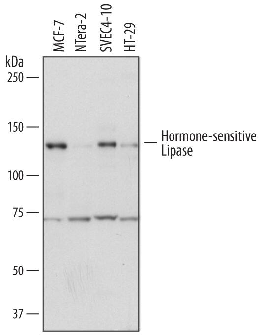 Western blot shows lysates of MCF-7 human breast cancer cell line, NTera-2 human testicular embryonic carcinoma cell line, SVEC4-10 mouse vascular endothelial cell line, and HT-29 human colon adenocarcinoma cell line. PVDF membrane was probed with 2 µg/mL of Mouse Anti-Human Hormone-sensitive Lipase/HSL Monoclonal Antibody (Catalog # MAB7104) followed by HRP-conjugated Anti-Mouse IgG Secondary Antibody (Catalog # HAF007). Specific bands were detected for Hormone-sensitive Lipase/HSL at approximately 70 kDa and 130 kDa (as indicated). This experiment was conducted under reducing conditions and using Immunoblot Buffer Group 1.