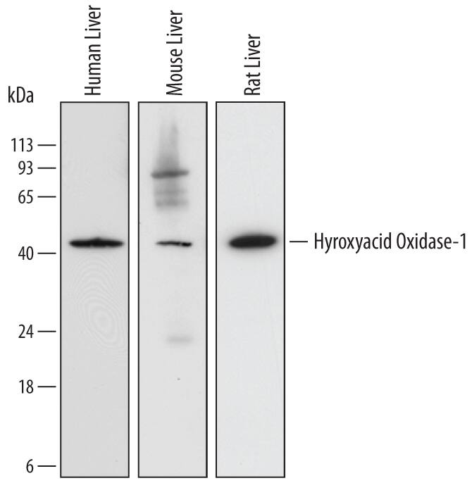 Western blot shows lysates of human liver tissue, mouse liver tissue, and rat liver tissue. PVDF membrane was probed with 0.2 µg/mL of Mouse Anti-Human/Mouse/Rat Hydroxyacid Oxidase-1/HAO-1 Monoclonal Antibody (Catalog # MAB6197) followed by HRP-conjugated Anti-Mouse IgG Secondary Antibody (Catalog # HAF007). A specific band was detected for Hydroxyacid Oxidase-1/ HAO-1 at approximately 42 kDa (as indicated). This experiment was conducted under reducing conditions and using Immunoblot Buffer Group 1.