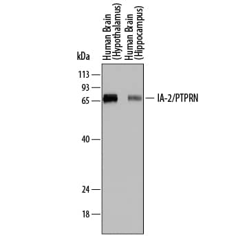 Western Blot IA-2/PTPRN Antibody (815811) [Unconjugated]