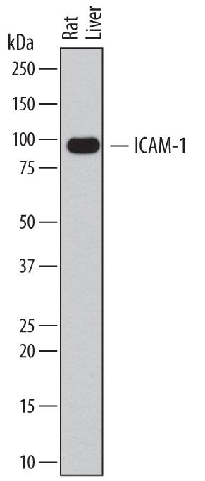 Western blot shows lysates of rat liver tissue. PVDF membrane was probed with 0.2 µg/mL of Goat Anti-Rat ICAM-1/CD54 Antigen Affinity-purified Polyclonal Antibody (Catalog # AF583) followed by HRP-conjugated Anti-Goat IgG Secondary Antibody (Catalog # HAF109). A specific band was detected for ICAM-1/CD54 at approximately 90 kDa (as indicated). This experiment was conducted under reducing conditions and using Immunoblot Buffer Group 1.