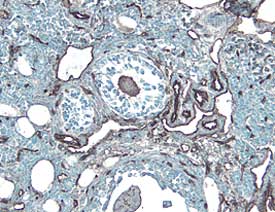 ICAM‑2/CD102 was detected in perfusion fixed frozen sections of mouse ovary using 15 &micro;g/mL Goat Anti-Mouse ICAM‑2/CD102 Antigen Affinity-purified Polyclonal Antibody (Catalog # AF774) overnight at 4 &deg;C. Tissue was stained with the Anti-Goat HRP-DAB Cell & Tissue Staining Kit (brown; Catalog # CTS008) and counterstained with hematoxylin (blue). View our protocol for Chromogenic IHC Staining of Frozen Tissue Sections.
