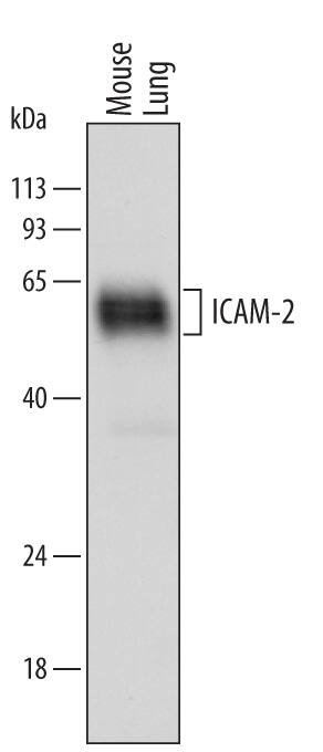 Western blot shows lysates of mouse lung tissue. PVDF membrane was probed with 0.25 µg/mL of Goat Anti-Mouse ICAM-2/CD102 Antigen Affinity-purified Polyclonal Antibody (Catalog # AF774) followed by HRP-conjugated Anti-Goat IgG Secondary Antibody (Catalog # HAF109). Specific bands were detected for ICAM-2/CD102 at approximately 50 to 60 kDa (as indicated). This experiment was conducted under reducing conditions and using Immunoblot Buffer Group 1.