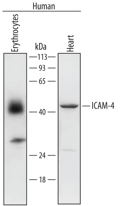 Western Blot ICAM-4 Antibody [Unconjugated]
