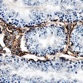 Immunohistochemistry ICAM-1/CD54 Antibody [Unconjugated]