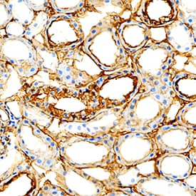 ICAM-1/CD54 was detected in immersion fixed paraffin-embedded sections of human kidney using Goat Anti-Mouse ICAM-1/CD54 Biotinylated Antigen Affinity-purified Polyclonal Antibody (Catalog # BAF796) at 5 µg/mL overnight at 4 °C. Tissue was stained using the Anti-Goat HRP-DAB Cell & Tissue Staining Kit (brown; Catalog # CTS008) and counterstained with hematoxylin (blue). Specific staining was localized to cell membrane in convoluted tubules. View our protocol for Chromogenic IHC Staining of Paraffin-embedded Tissue Sections.
