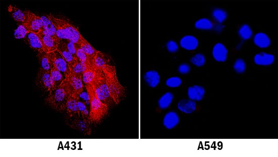 ICAM-1/CD54 was detected in immersion fixed A431 human epithelial carcinoma cell line using Goat Anti-Human ICAM-1/CD54 Polyclonal Antibody (Catalog # BBA17) at 1:600 dilution for 3 hours at room temperature. Cells were stained using the NorthernLights™ 557-conjugated Anti-Goat IgG Secondary Antibody (red; Catalog # NL001) and counterstained with DAPI (blue). Specific staining was localized to plasma membrane. View our protocol for Fluorescent ICC Staining of Cells on Coverslips.