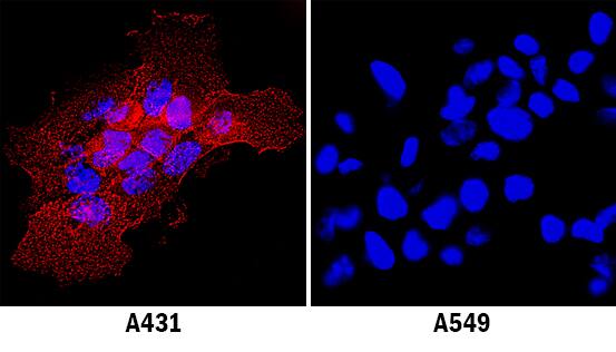 ICAM-1/CD54 was detected in immersion fixed A431 human epithelial carcinoma cell line using Mouse Anti-Human ICAM-1/CD54 Monoclonal Antibody (Catalog # MAB720) at 25 µg/mL for 3 hours at room temperature. Cells were stained using the NorthernLights™ 557-conjugated Anti-Mouse IgG Secondary Antibody (red; Catalog # NL007) and counterstained with DAPI (blue). Specific staining was localized to plasma membrane. View our protocol for Fluorescent ICC Staining of Cells on Coverslips.