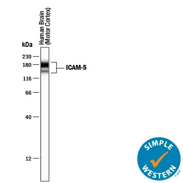 Simple Western lane view shows lysates of human brain (motor cortex) tissue, loaded at 0.2 mg/mL. Specific bands were detected for ICAM-5 at approximately 146 and 180 kDa (as indicated) using 1 µg/mL of Goat Anti-Human ICAM-5 Antigen Affinity-purified Polyclonal Antibody (Catalog # AF1950) followed by 1:50 dilution of HRP-conjugated Anti-Goat IgG Secondary Antibody (Catalog # HAF109). This experiment was conducted under reducing conditions and using the 12-230 kDa separation system.