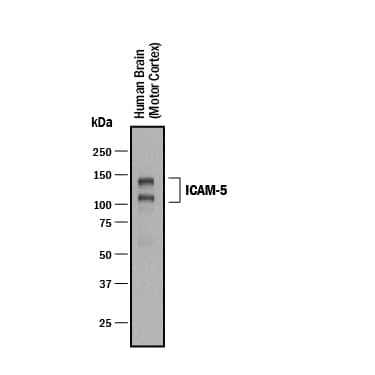 Western blot shows lysates of human brain (motor cortex) tissue. PVDF membrane was probed with 0.1 µg/mL of Goat Anti-Human ICAM-5 Antigen Affinity-purified Polyclonal Antibody (Catalog # AF1950) followed by HRP-conjugated Anti-Goat IgG Secondary Antibody (Catalog # HAF017). Specific bands were detected for ICAM-5 at approximately 115 and 140 kDa (as indicated). This experiment was conducted under reducing conditions and using Immunoblot Buffer Group 1.