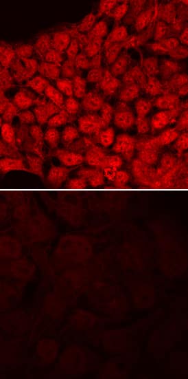 Immunocytochemistry ID1 Antibody [Unconjugated]