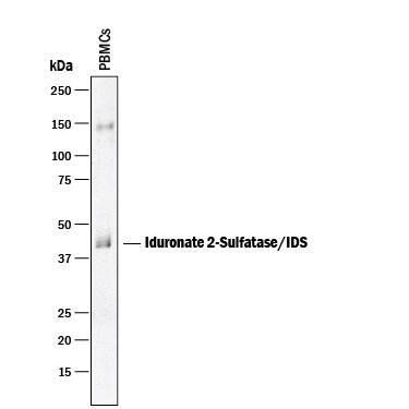 Western Blot Iduronate 2-Sulfatase/IDS Antibody [Unconjugated]
