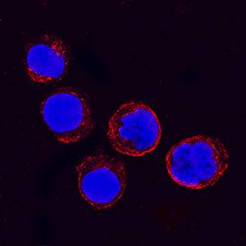 Immunocytochemistry IFITM1 Antibody [Unconjugated]