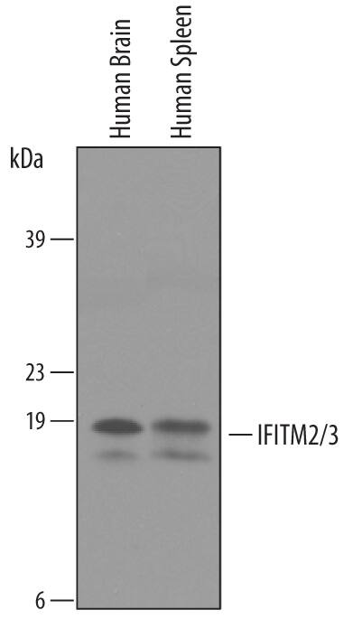 Western blot shows lysates of human brain tissue and human spleen tissue. PVDF membrane was probed with 1 µg/mL of Goat Anti-Human IFITM2/3 Antigen Affinity-purified Polyclonal Antibody (Catalog # AF4834) followed by HRP-conjugated Anti-Goat IgG Secondary Antibody (Catalog # HAF019). Specific bands were detected for IFITM2 and IFITM3 at approximately 15 and 17 kDa (as indicated). This experiment was conducted under reducing conditions and using Immunoblot Buffer Group 8.